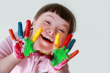 Other challenges besides neurodevelopmental disorders or developmental disorders that children can face include Down Syndrome